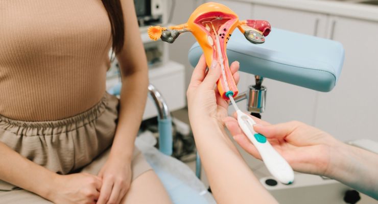 Gynecologist,Demonstrates,Intrauterine,Device,Iud,Insertion,Using,Uterus,Model.,Gynecologist